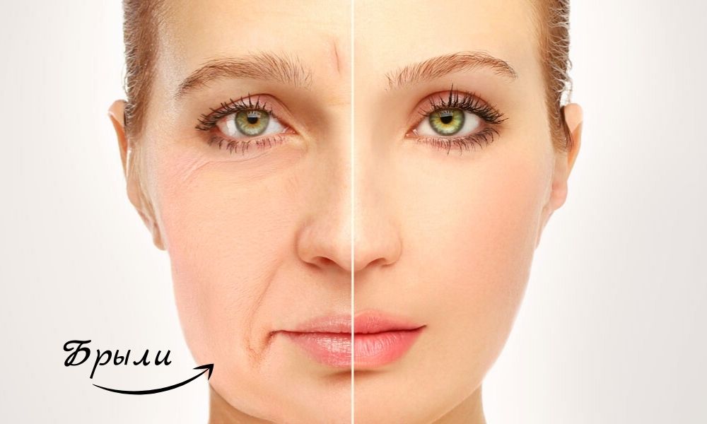 Как убрать брыли на лице? Как убрать брыли на лице?